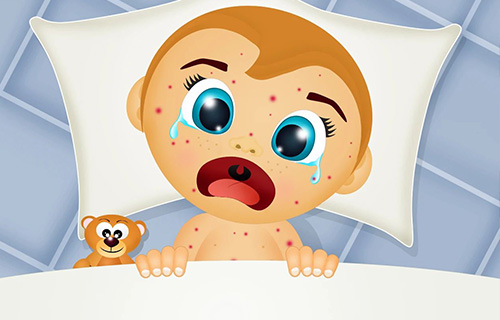 “神兽”已经归笼，家长开心之余要警惕这个传染病！