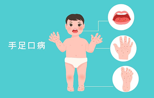 @家长们，莫把猩红热当成感冒治疗！