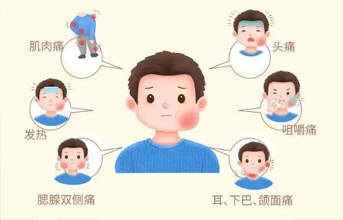 预防流行性腮腺炎 守护健康